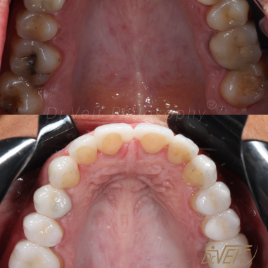 https_drveit.com.br_casos-clinicos_reabilitacao-oral-transdisciplinar-16__4