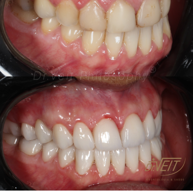 https_drveit.com.br_casos-clinicos_reabilitacao-oral-transdisciplinar-16__6