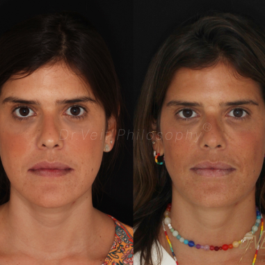 https_drveit.com.br_casos-clinicos_reabilitacao-oral-transdisciplinar-16__7