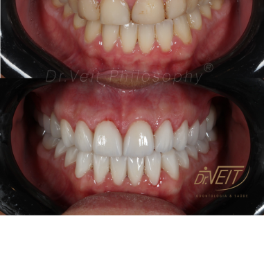 https_drveit.com.br_casos-clinicos_reabilitacao-oral-transdisciplinar-16__8