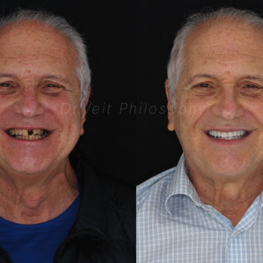 https_drveit.com.br_casos-clinicos_reabilitacao-oral-transdisciplinar-17__1