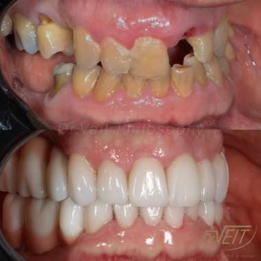 https_drveit.com.br_casos-clinicos_reabilitacao-oral-transdisciplinar-17__11