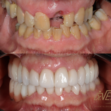 https_drveit.com.br_casos-clinicos_reabilitacao-oral-transdisciplinar-17__12