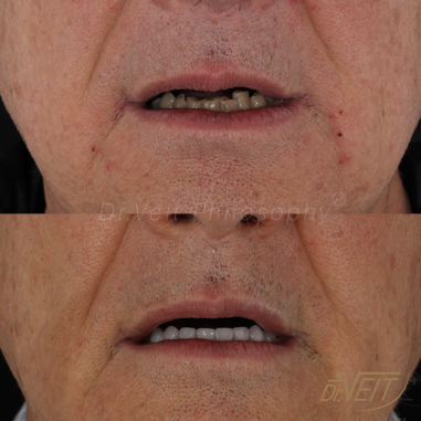 https_drveit.com.br_casos-clinicos_reabilitacao-oral-transdisciplinar-17__13