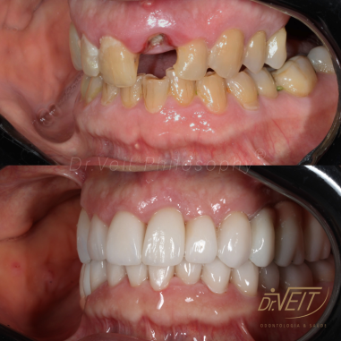 https_drveit.com.br_casos-clinicos_reabilitacao-oral-transdisciplinar-17__14