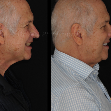 https_drveit.com.br_casos-clinicos_reabilitacao-oral-transdisciplinar-17__17