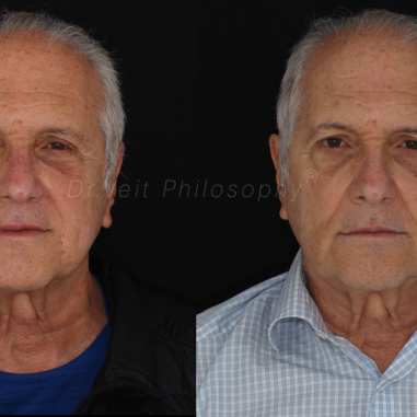 https_drveit.com.br_casos-clinicos_reabilitacao-oral-transdisciplinar-17__2