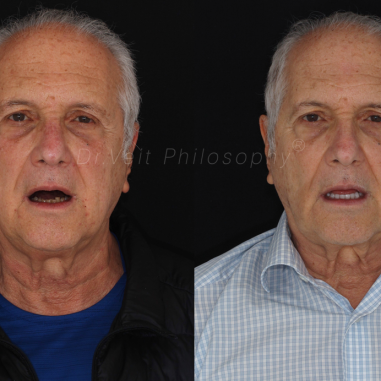 https_drveit.com.br_casos-clinicos_reabilitacao-oral-transdisciplinar-17__6