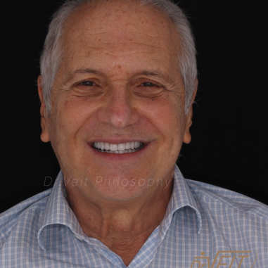 https_drveit.com.br_casos-clinicos_reabilitacao-oral-transdisciplinar-17__7