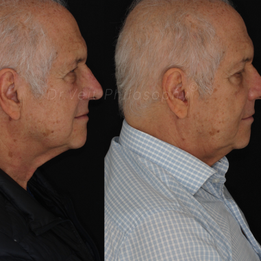 https_drveit.com.br_casos-clinicos_reabilitacao-oral-transdisciplinar-17__8