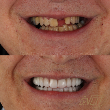 https_drveit.com.br_casos-clinicos_reabilitacao-oral-transdisciplinar-17__9