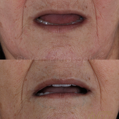 https_drveit.com.br_casos-clinicos_reabilitacao-oral-transdisciplinar-18__10