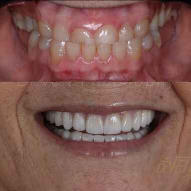 https_drveit.com.br_casos-clinicos_reabilitacao-oral-transdisciplinar-18__13