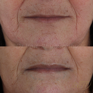 https_drveit.com.br_casos-clinicos_reabilitacao-oral-transdisciplinar-18__14