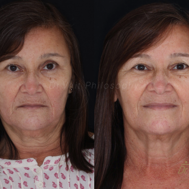 https_drveit.com.br_casos-clinicos_reabilitacao-oral-transdisciplinar-18__15