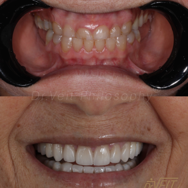 https_drveit.com.br_casos-clinicos_reabilitacao-oral-transdisciplinar-18__18