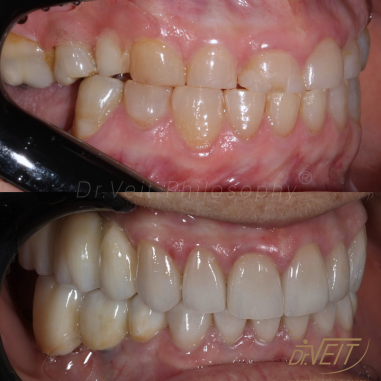 https_drveit.com.br_casos-clinicos_reabilitacao-oral-transdisciplinar-18__19