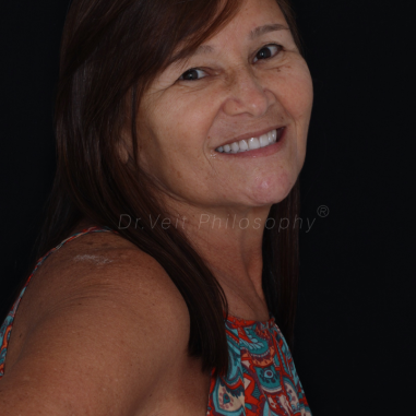 https_drveit.com.br_casos-clinicos_reabilitacao-oral-transdisciplinar-18__22