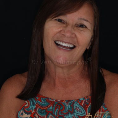 https_drveit.com.br_casos-clinicos_reabilitacao-oral-transdisciplinar-18__6