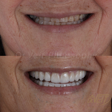 https_drveit.com.br_casos-clinicos_reabilitacao-oral-transdisciplinar-18__8