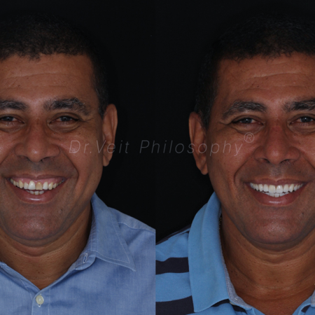 https_drveit.com.br_casos-clinicos_reabilitacao-oral-transdisciplinar-19__1