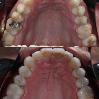 https_drveit.com.br_casos-clinicos_reabilitacao-oral-transdisciplinar-19__11