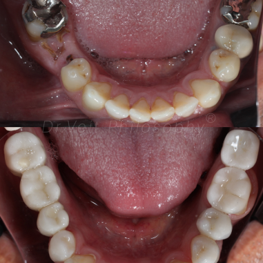 https_drveit.com.br_casos-clinicos_reabilitacao-oral-transdisciplinar-19__13