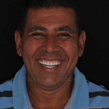 https_drveit.com.br_casos-clinicos_reabilitacao-oral-transdisciplinar-19__14