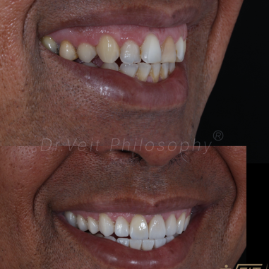 https_drveit.com.br_casos-clinicos_reabilitacao-oral-transdisciplinar-19__15