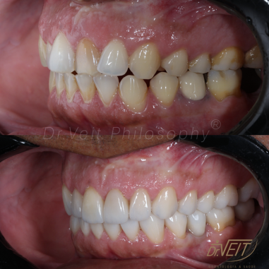 https_drveit.com.br_casos-clinicos_reabilitacao-oral-transdisciplinar-19__16