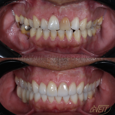 https_drveit.com.br_casos-clinicos_reabilitacao-oral-transdisciplinar-19__17