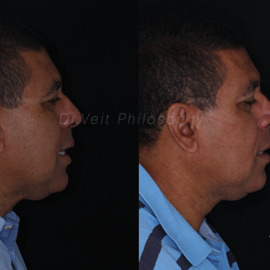 https_drveit.com.br_casos-clinicos_reabilitacao-oral-transdisciplinar-19__18