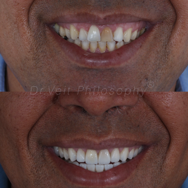 https_drveit.com.br_casos-clinicos_reabilitacao-oral-transdisciplinar-19__19