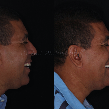 https_drveit.com.br_casos-clinicos_reabilitacao-oral-transdisciplinar-19__2