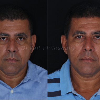 https_drveit.com.br_casos-clinicos_reabilitacao-oral-transdisciplinar-19__20