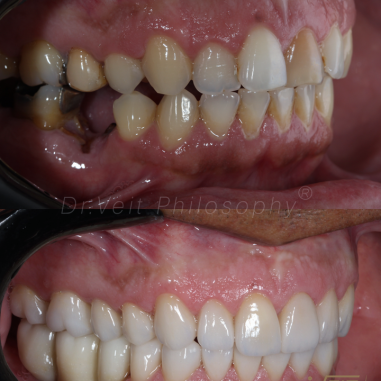 https_drveit.com.br_casos-clinicos_reabilitacao-oral-transdisciplinar-19__21