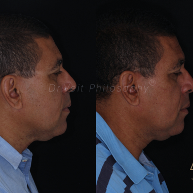 https_drveit.com.br_casos-clinicos_reabilitacao-oral-transdisciplinar-19__3