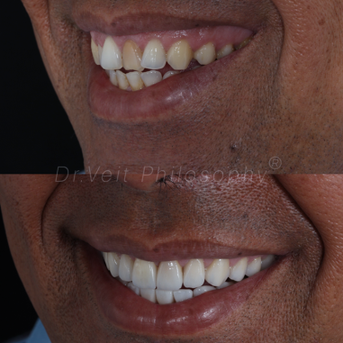 https_drveit.com.br_casos-clinicos_reabilitacao-oral-transdisciplinar-19__4