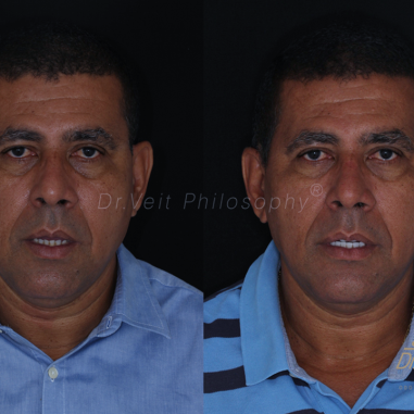 https_drveit.com.br_casos-clinicos_reabilitacao-oral-transdisciplinar-19__5