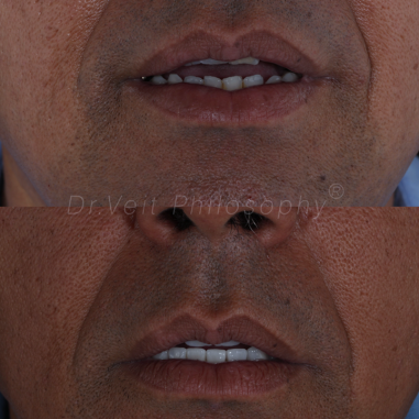 https_drveit.com.br_casos-clinicos_reabilitacao-oral-transdisciplinar-19__6