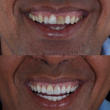 https_drveit.com.br_casos-clinicos_reabilitacao-oral-transdisciplinar-19__7