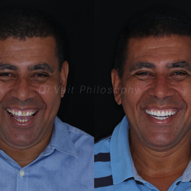 https_drveit.com.br_casos-clinicos_reabilitacao-oral-transdisciplinar-19__8