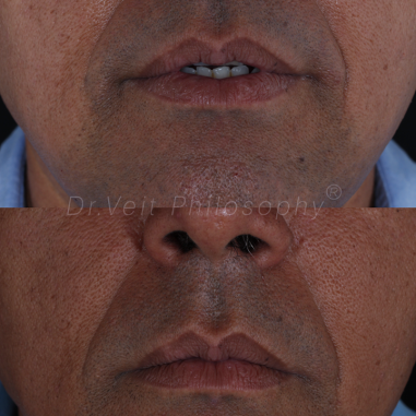 https_drveit.com.br_casos-clinicos_reabilitacao-oral-transdisciplinar-19__9