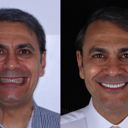 https_drveit.com.br_casos-clinicos_reabilitacao-oral-transdisciplinar-4__1