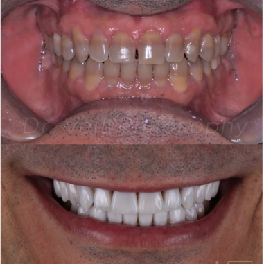 https_drveit.com.br_casos-clinicos_reabilitacao-oral-transdisciplinar-4__10
