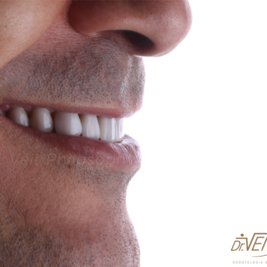 https_drveit.com.br_casos-clinicos_reabilitacao-oral-transdisciplinar-4__7