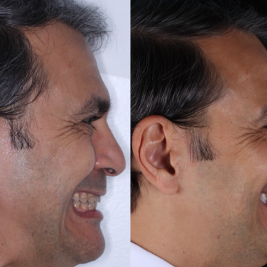 https_drveit.com.br_casos-clinicos_reabilitacao-oral-transdisciplinar-4__9