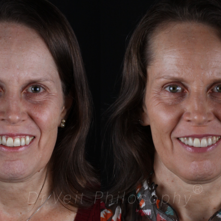 https_drveit.com.br_casos-clinicos_reabilitacao-oral-transdisciplinar-5__1