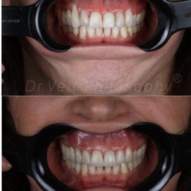 https_drveit.com.br_casos-clinicos_reabilitacao-oral-transdisciplinar-5__3