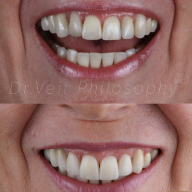 https_drveit.com.br_casos-clinicos_reabilitacao-oral-transdisciplinar-5__5